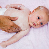 eczema